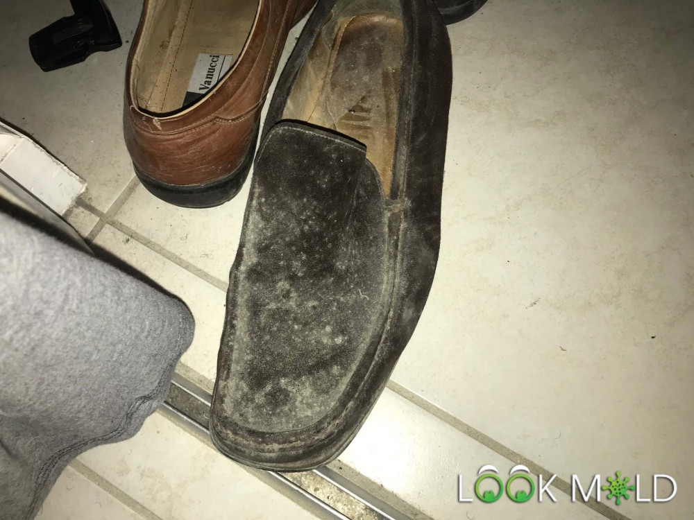 White-Mold-On-Shoes